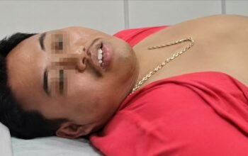 Ditangkap Saat Sedot Lemak, Pelarian Bos Gendut Berakhir di Kampung Bahari