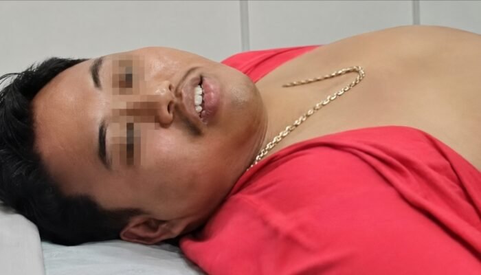 Ditangkap Saat Sedot Lemak, Pelarian Bos Gendut Berakhir di Kampung Bahari