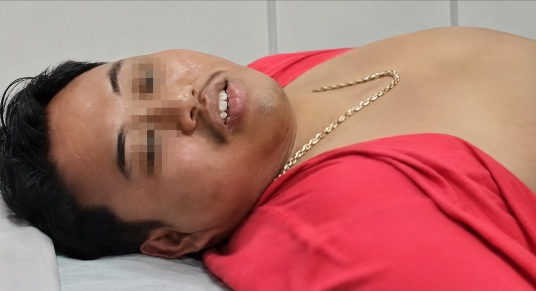 Bos Gendut ditangkap BNN saat menjalani sedot lemak