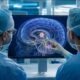 Dokter menggunakan AI untuk membantu operasi tumor otak di London